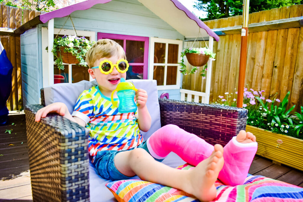 Child with broken tibia and pink plaster cast
